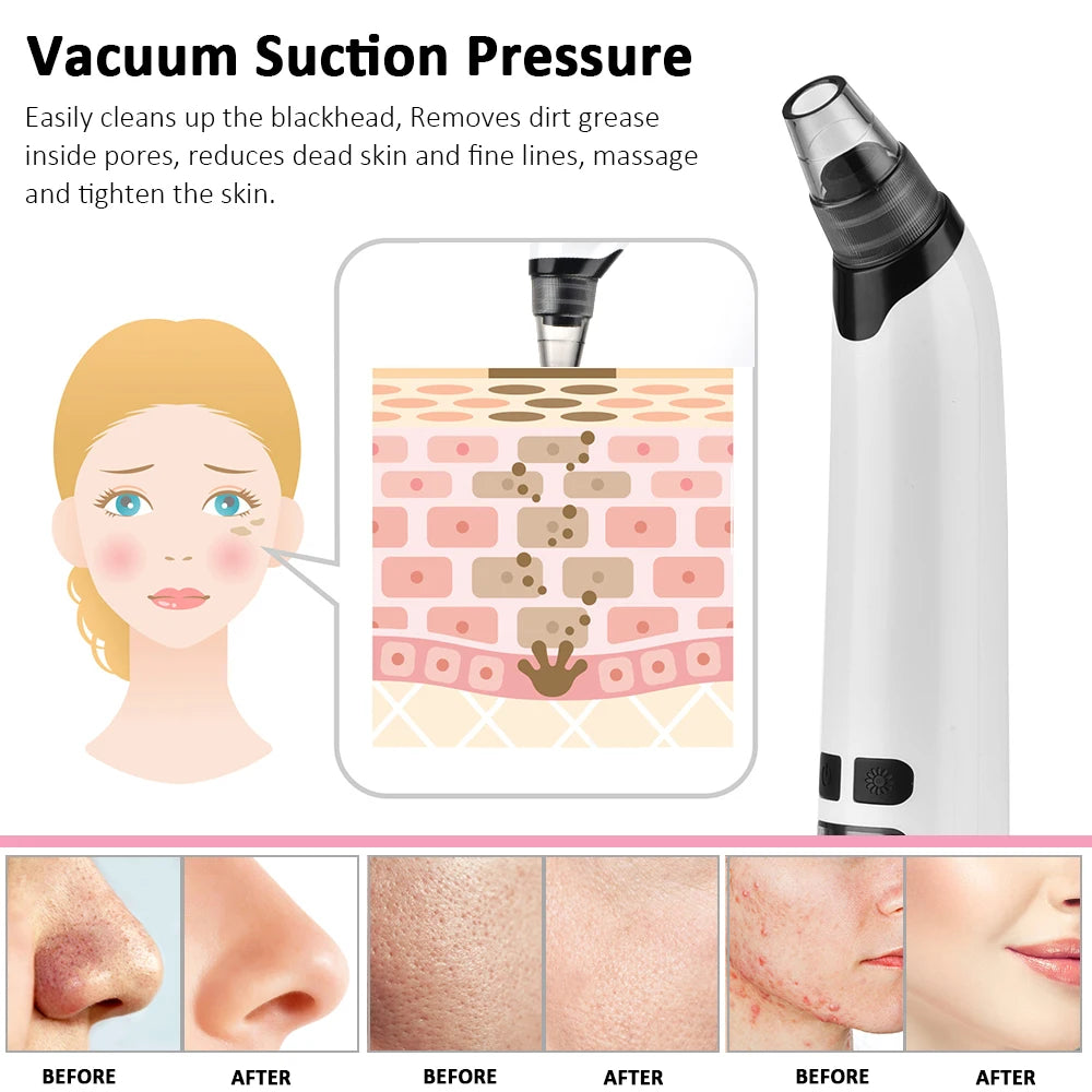 Beauty Electric Blackhead Remover Facial Cleaner Black Point Vacuum Suction Black Head Dots Remover Extractor Skin Care Tools