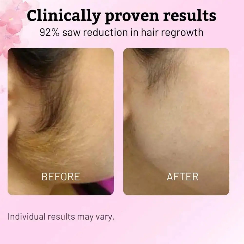 Hair Removal Care Serum Relieves Gentle Moisturizing Care Skin Smooth Nourishing Skin for After Hair Removal and Shaving