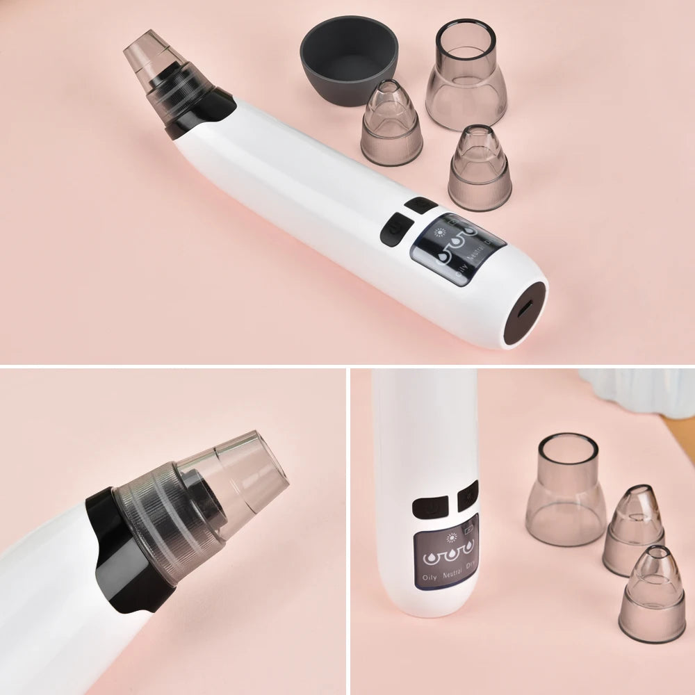 Beauty Electric Blackhead Remover Facial Cleaner Black Point Vacuum Suction Black Head Dots Remover Extractor Skin Care Tools